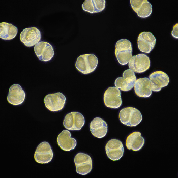 暗視野観察のイメージ